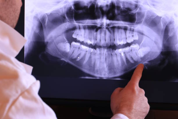 Best Broken or Chipped Tooth Repair in Bowling Green, KY
